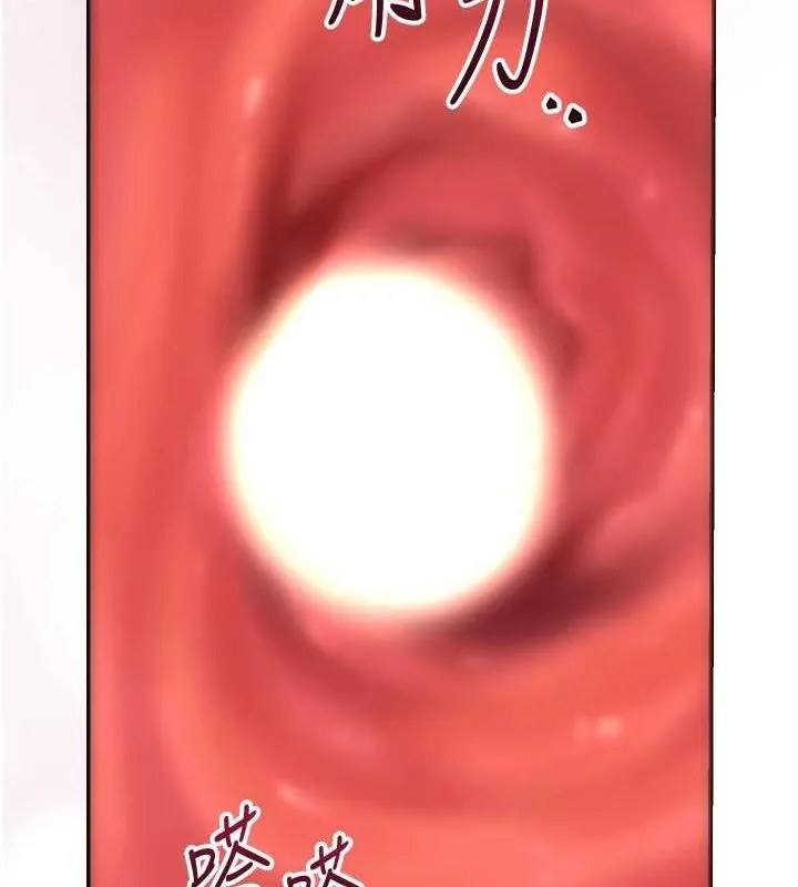 77